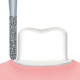Restorative(For Preparation of crown cores)/S83D -AIR SCALER